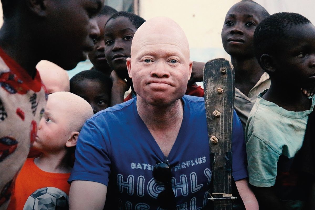 Lazarus Is the Malawi Street Musician Fighting Against the Persecution of People With Albinism