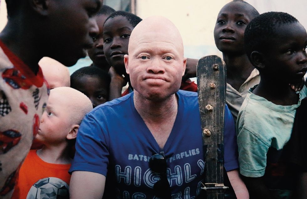 Lazarus Is the Malawi Street Musician Fighting Against the Persecution of People With Albinism