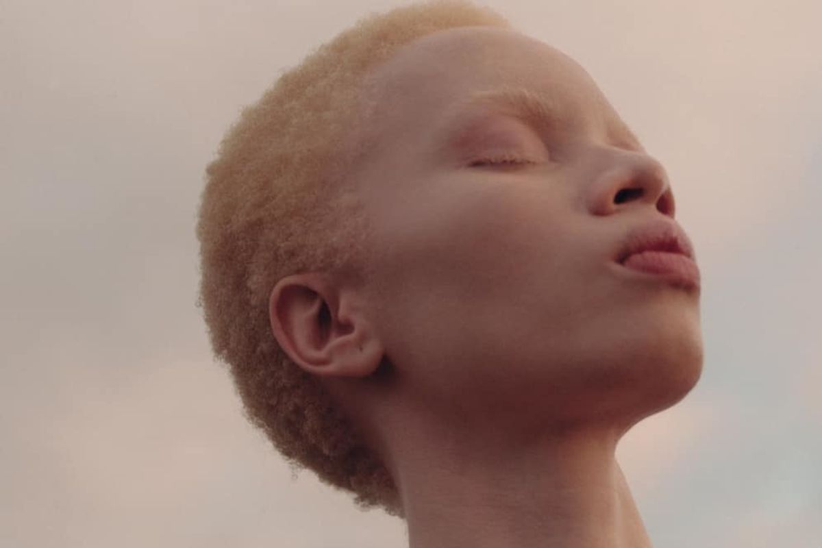 Thando Hopa Makes History as the First Woman with Albinism on a Vogue Cover